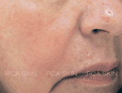 {{brizy_dc_image_alt imageSrc=